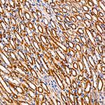 FGFR1 Antibody in Immunohistochemistry (Paraffin) (IHC (P))