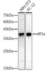 EIF2S1 Antibody in Western Blot (WB)