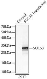 SOCS3 Antibody in Western Blot (WB)