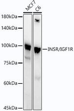 IR/IGF1R Antibody in Western Blot (WB)