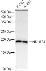 NDUFS4 Antibody in Western Blot (WB)