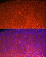 STAR Antibody in Immunocytochemistry (ICC/IF)