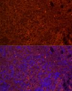 STAR Antibody in Immunocytochemistry (ICC/IF)