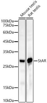 STAR Antibody in Western Blot (WB)