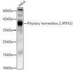 PITX2 Antibody in Western Blot (WB)