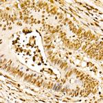 NAMPT Antibody in Immunohistochemistry (Paraffin) (IHC (P))