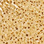 NAMPT Antibody in Immunohistochemistry (Paraffin) (IHC (P))