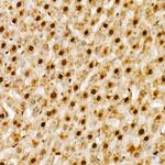 NAMPT Antibody in Immunohistochemistry (Paraffin) (IHC (P))