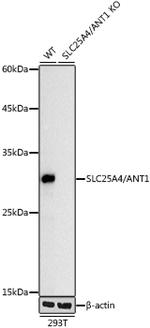 ANT Antibody in Western Blot (WB)