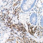 PKC beta Antibody in Immunohistochemistry (Paraffin) (IHC (P))