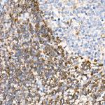 PKC beta Antibody in Immunohistochemistry (Paraffin) (IHC (P))