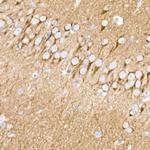 PKC beta Antibody in Immunohistochemistry (Paraffin) (IHC (P))