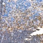 PKC beta Antibody in Immunohistochemistry (Paraffin) (IHC (P))