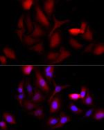 AKR1B1 Antibody in Immunocytochemistry (ICC/IF)