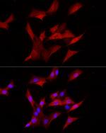 AKR1B1 Antibody in Immunocytochemistry (ICC/IF)