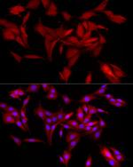 AKR1B1 Antibody in Immunocytochemistry (ICC/IF)