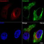 Caveolin 1 Antibody in Immunocytochemistry (ICC/IF)