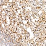 Clusterin Alpha Antibody in Immunohistochemistry (Paraffin) (IHC (P))