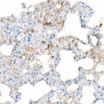 IL-6 Antibody in Immunohistochemistry (Paraffin) (IHC (P))