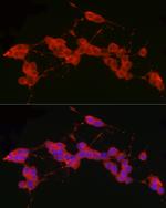 RET Antibody in Immunocytochemistry (ICC/IF)