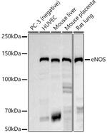 eNOS Antibody in Western Blot (WB)