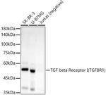 TGFBR1 Antibody in Western Blot (WB)