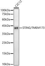 STING Antibody in Western Blot (WB)