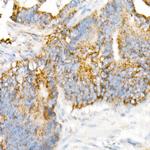 VDAC2 Antibody in Immunohistochemistry (Paraffin) (IHC (P))