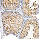 VDAC2 Antibody in Immunohistochemistry (Paraffin) (IHC (P))