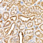 VDAC2 Antibody in Immunohistochemistry (Paraffin) (IHC (P))