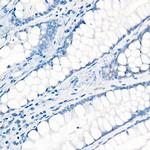 YAP1 Antibody in Immunohistochemistry (Paraffin) (IHC (P))