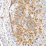 YAP1 Antibody in Immunohistochemistry (Paraffin) (IHC (P))