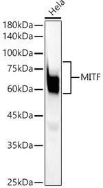 MiTF Antibody in Western Blot (WB)