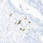 S100A9 Antibody in Immunohistochemistry (Paraffin) (IHC (P))