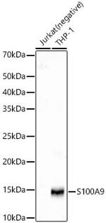 S100A9 Antibody in Western Blot (WB)