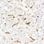 Gelsolin Antibody in Immunohistochemistry (Paraffin) (IHC (P))