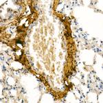 COL1A1 Antibody in Immunohistochemistry (Paraffin) (IHC (P))