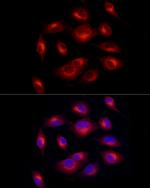 Melan-A Antibody in Immunocytochemistry (ICC/IF)