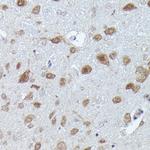 PFKFB3 Antibody in Immunohistochemistry (Paraffin) (IHC (P))