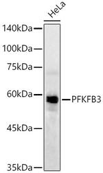 PFKFB3 Antibody in Western Blot (WB)