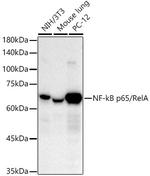 NFkB p65 Antibody in Western Blot (WB)