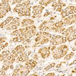 PFKP Antibody in Immunohistochemistry (Paraffin) (IHC (P))