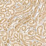 PFKP Antibody in Immunohistochemistry (Paraffin) (IHC (P))