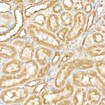 PFKP Antibody in Immunohistochemistry (Paraffin) (IHC (P))