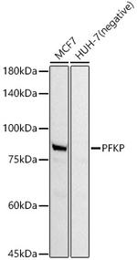 PFKP Antibody in Western Blot (WB)