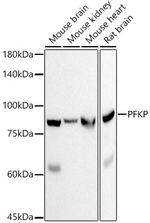 PFKP Antibody in Western Blot (WB)