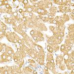 Calreticulin Antibody in Immunohistochemistry (Paraffin) (IHC (P))