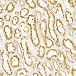 Calreticulin Antibody in Immunohistochemistry (Paraffin) (IHC (P))