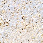 Calreticulin Antibody in Immunohistochemistry (Paraffin) (IHC (P))