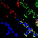 MAP2 Antibody in Immunocytochemistry (ICC/IF)